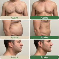 Drainage Lymphatique